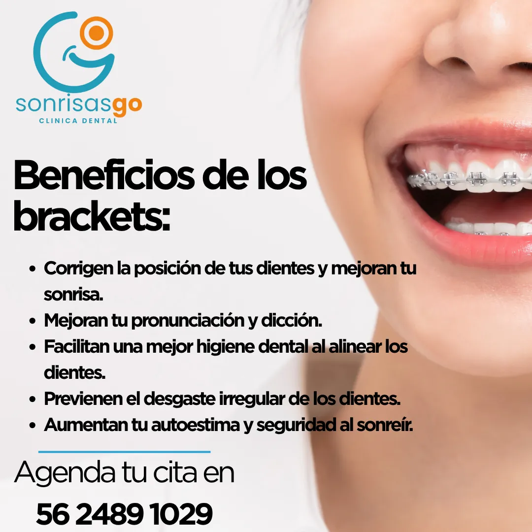 Diseño 48