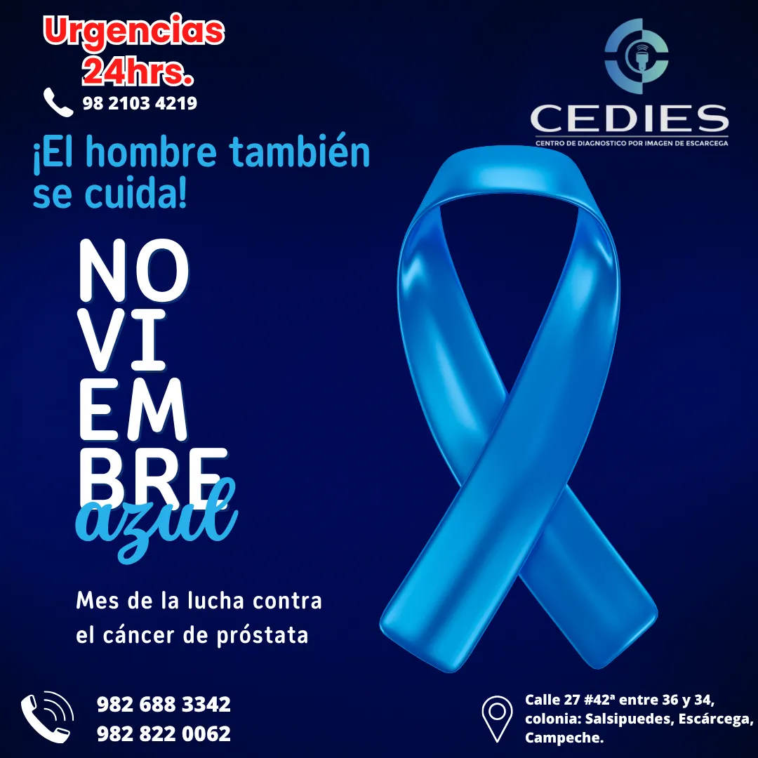 Diseño 55