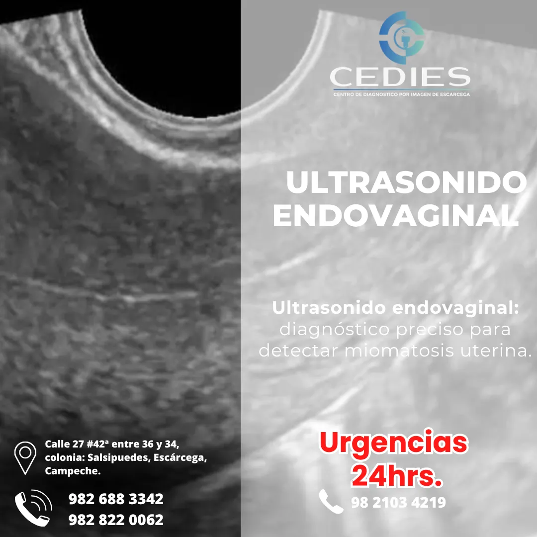 Diseño 25