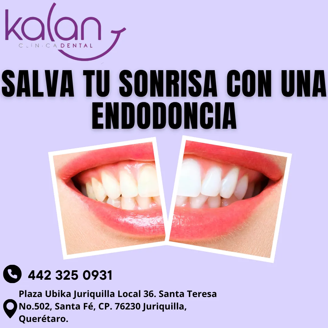 Diseño 32