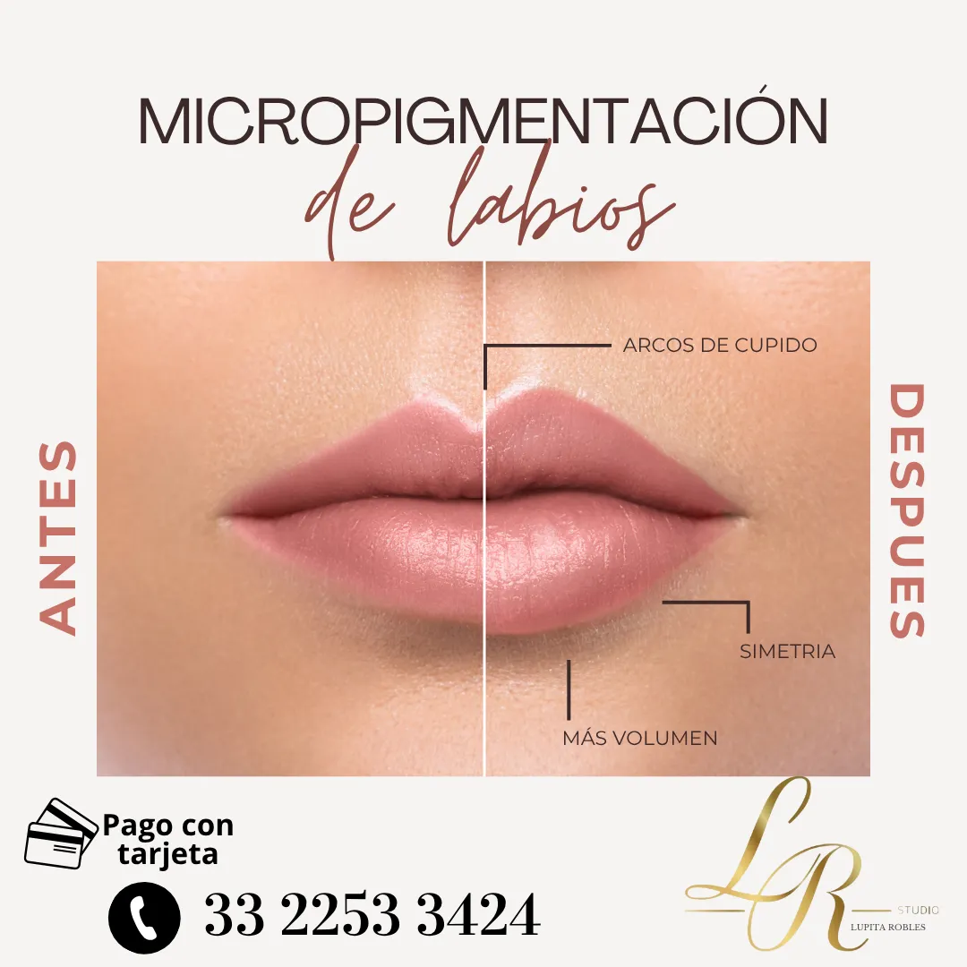 Diseño 76