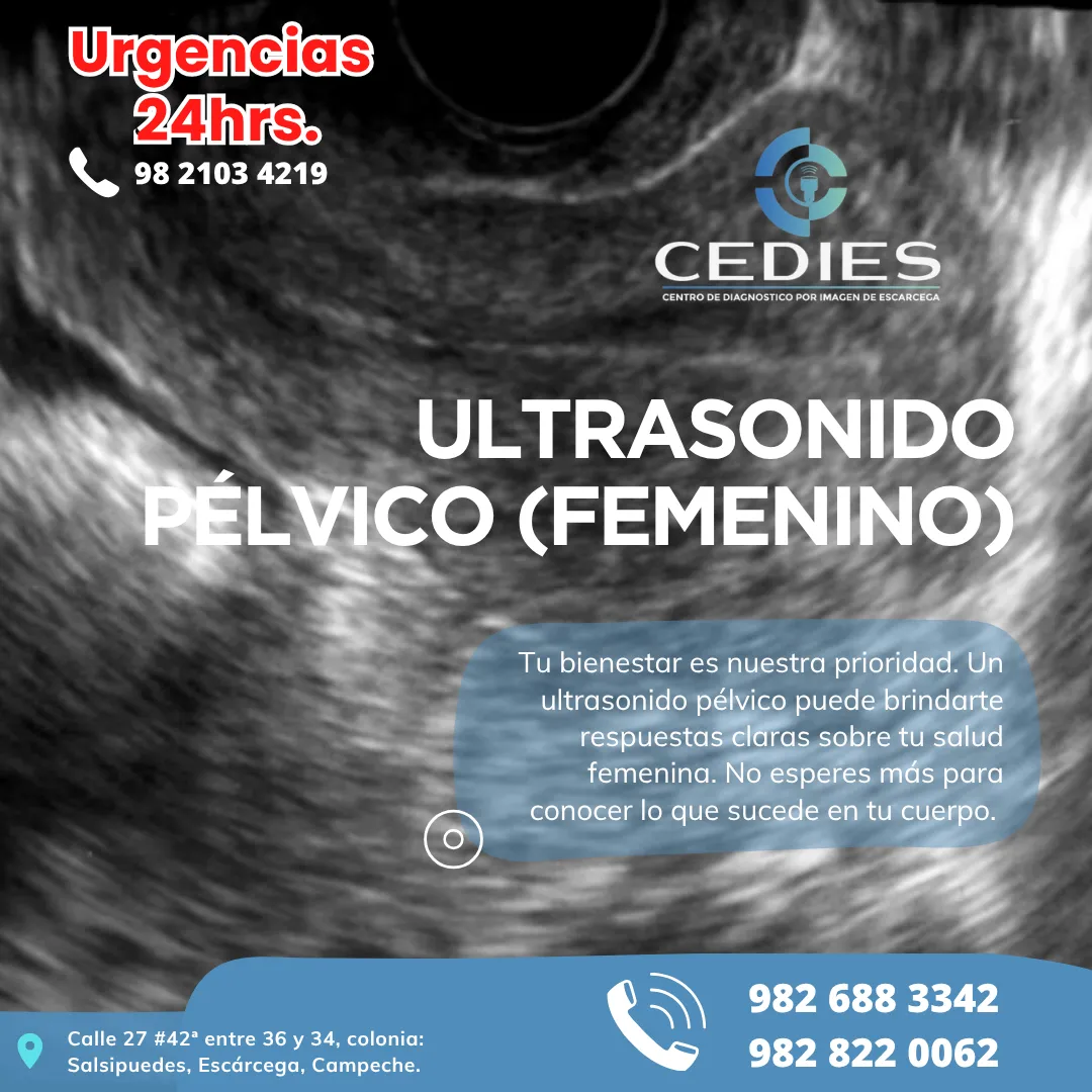 Diseño 29