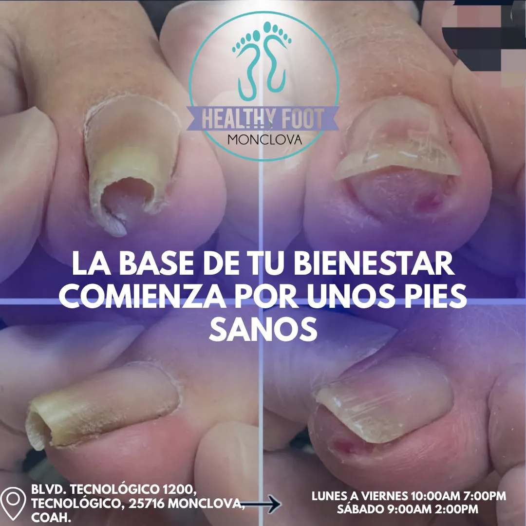 Diseño 101