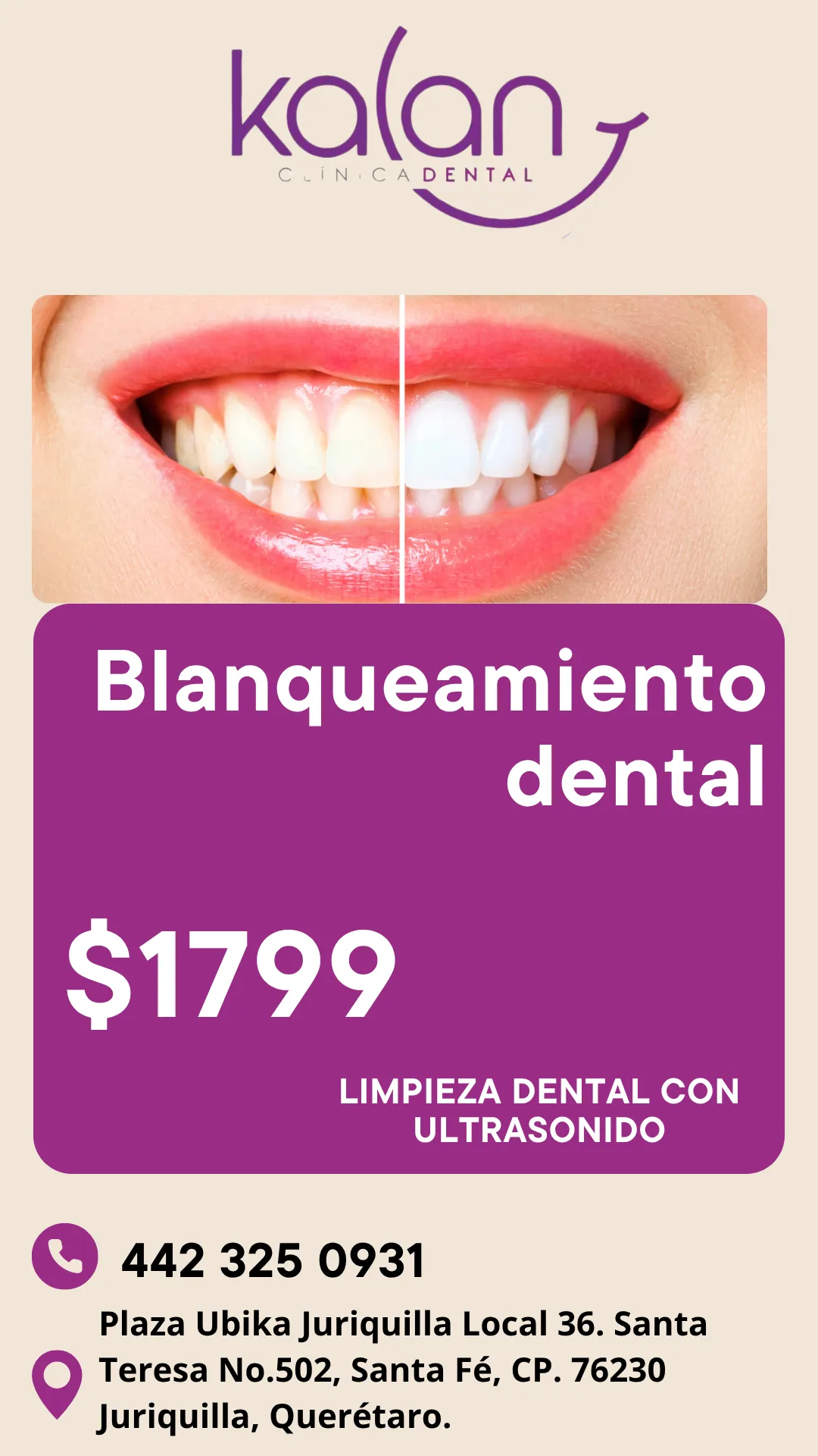 Diseño 82