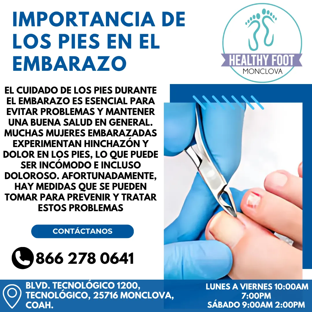 Diseño 60