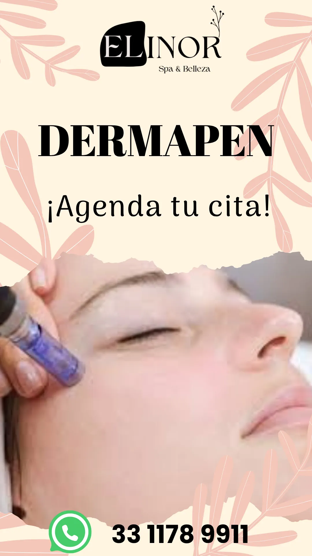 Diseño 100