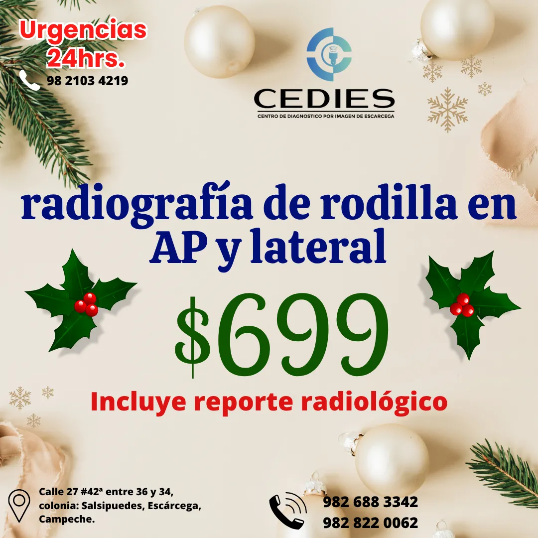 Diseño 91