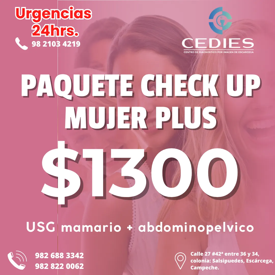 Diseño 41