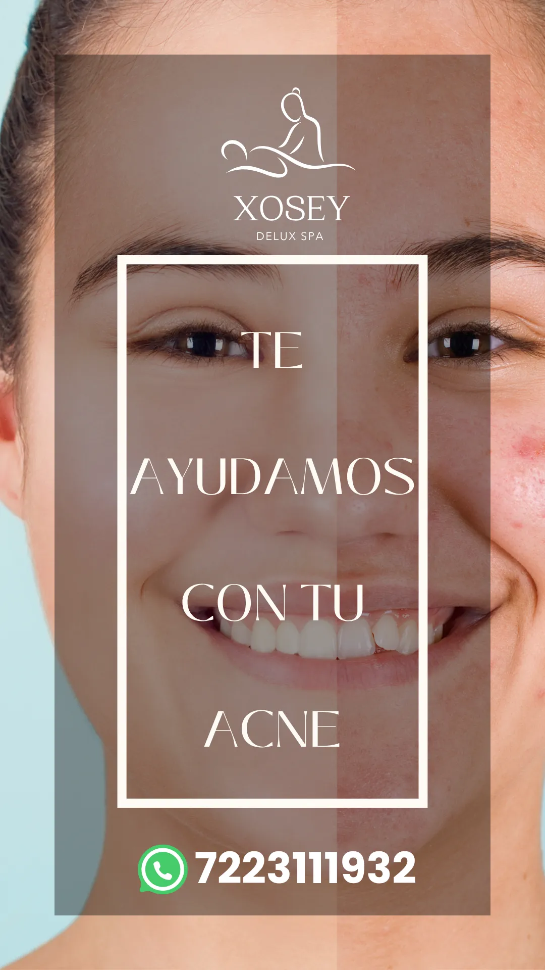 Diseño 9