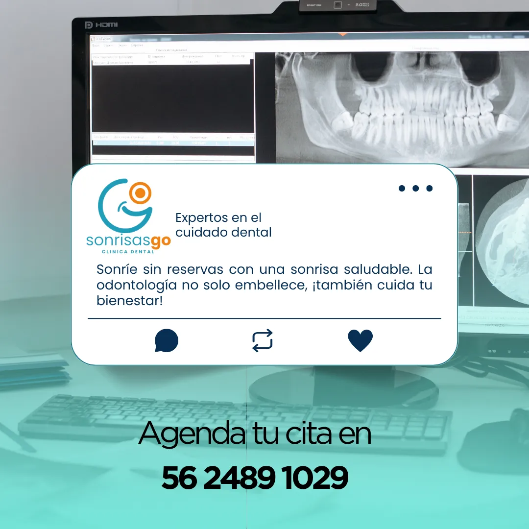 Diseño 36