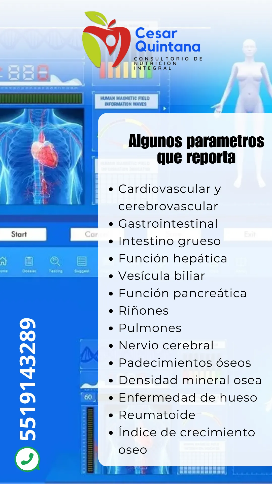 Diseño 45