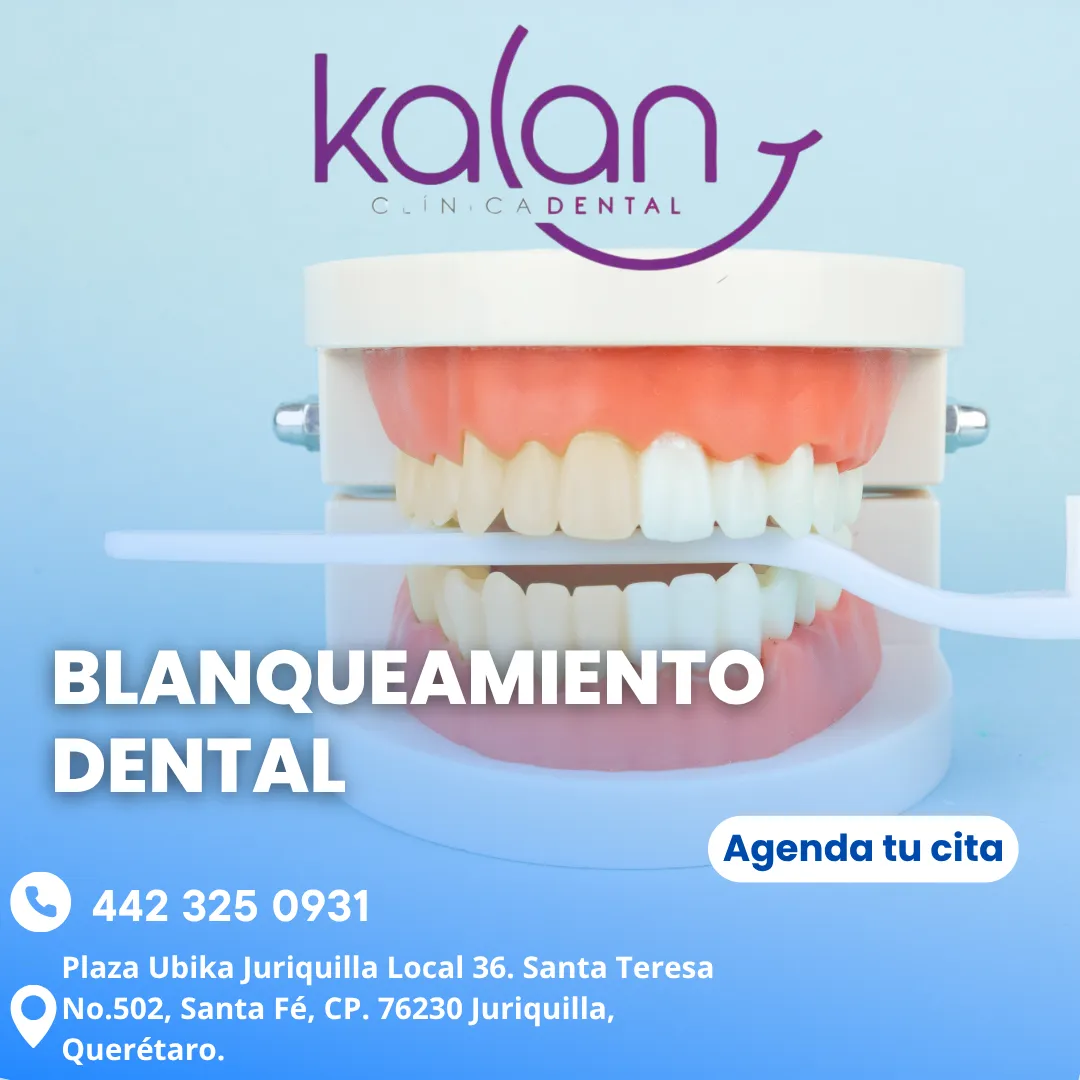 Diseño 26