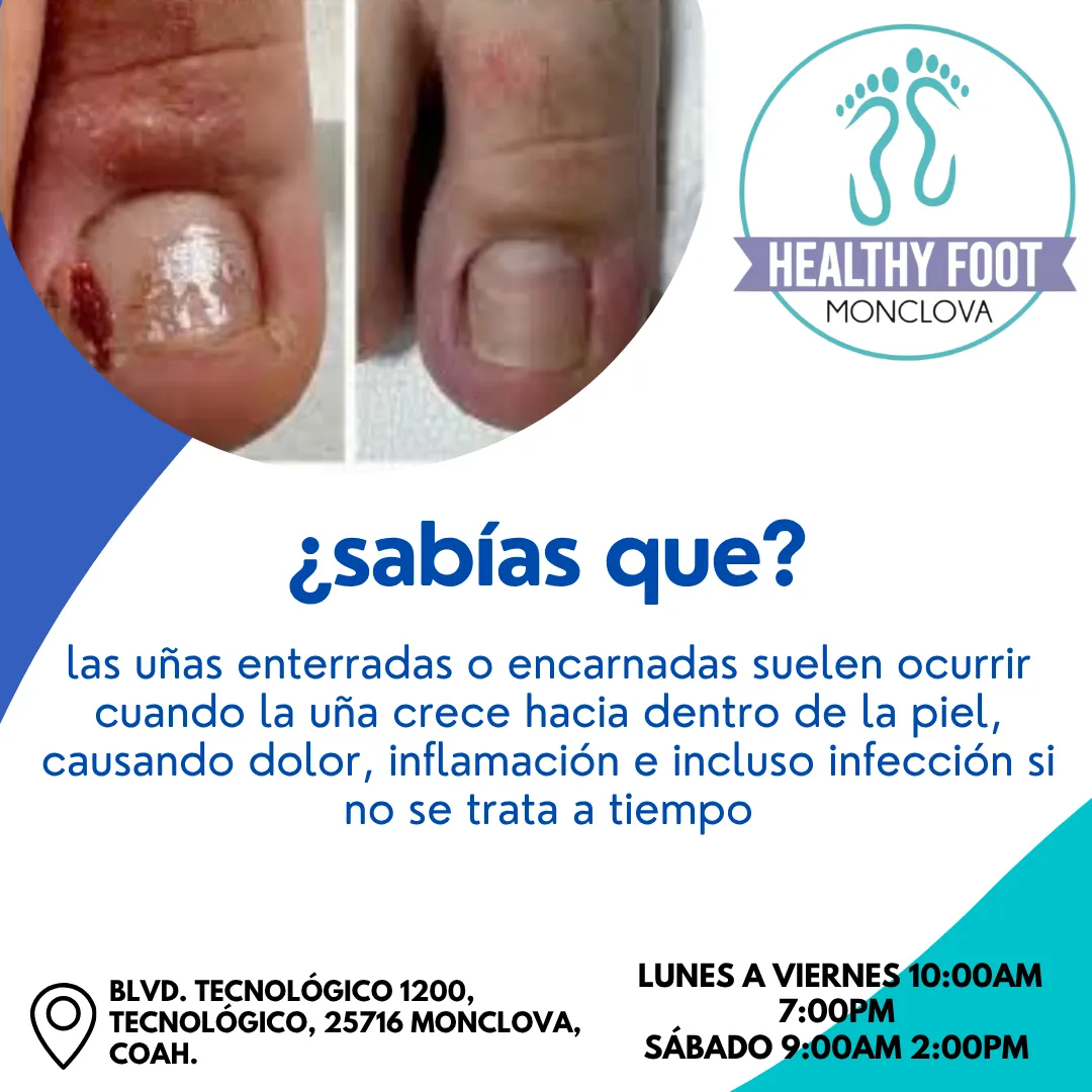 Diseño 139