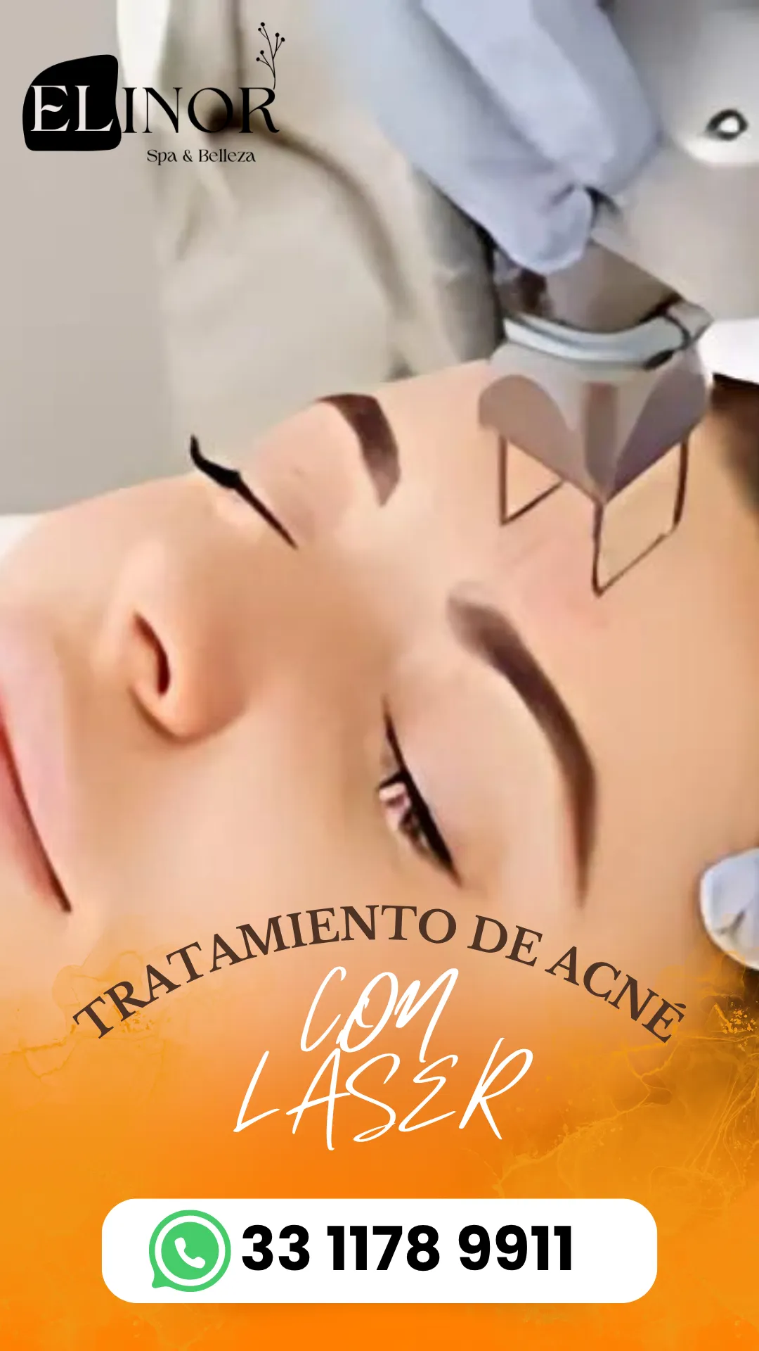 Diseño 148