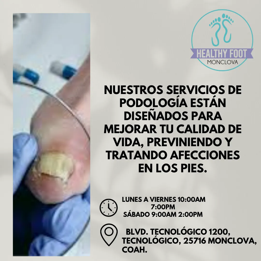 Diseño 24
