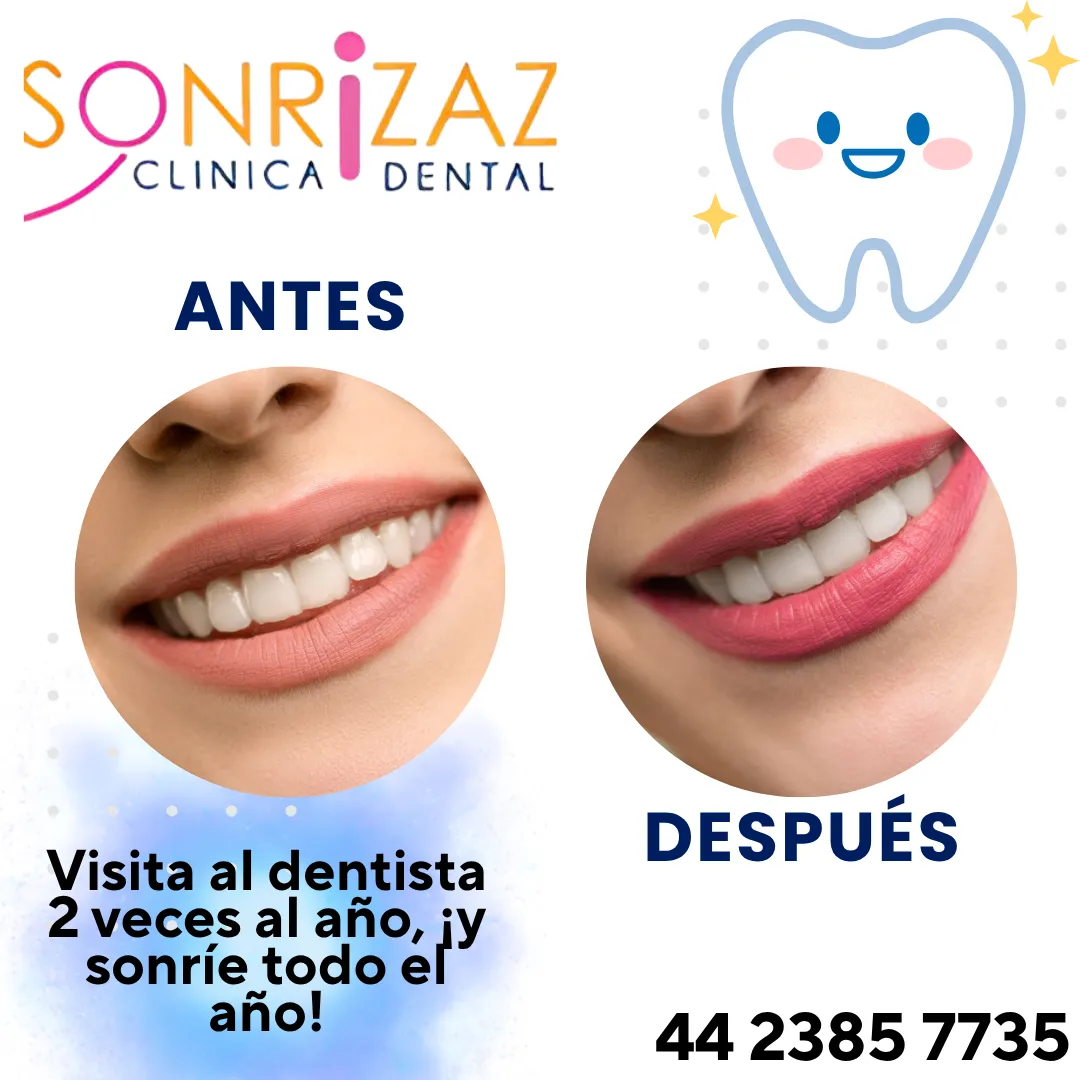 Diseño 41