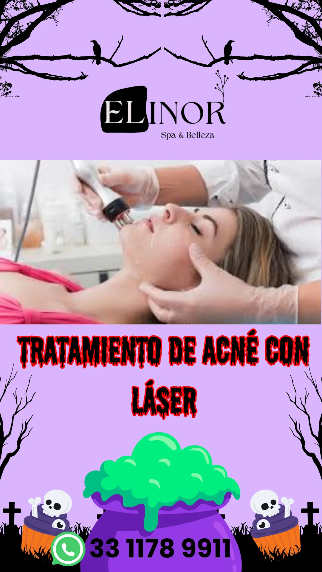 Diseño 15