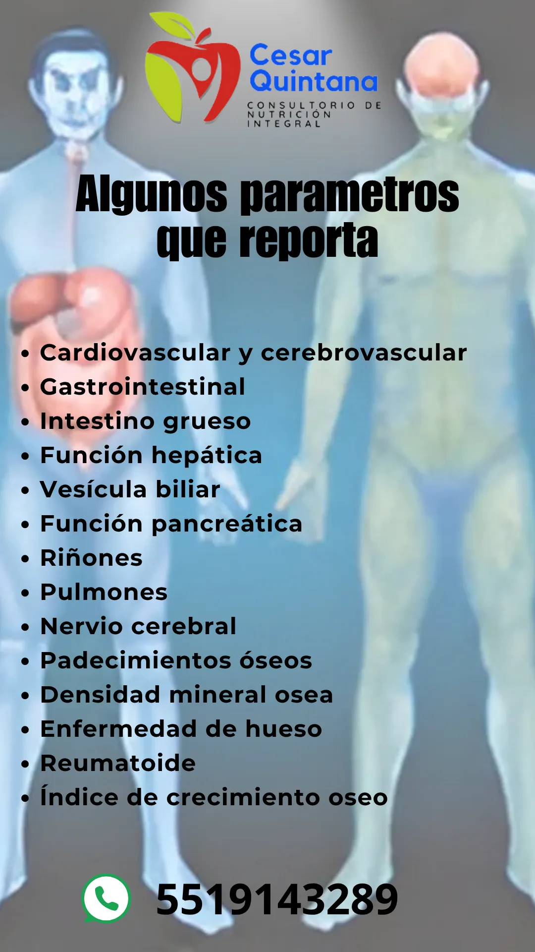 Diseño 57