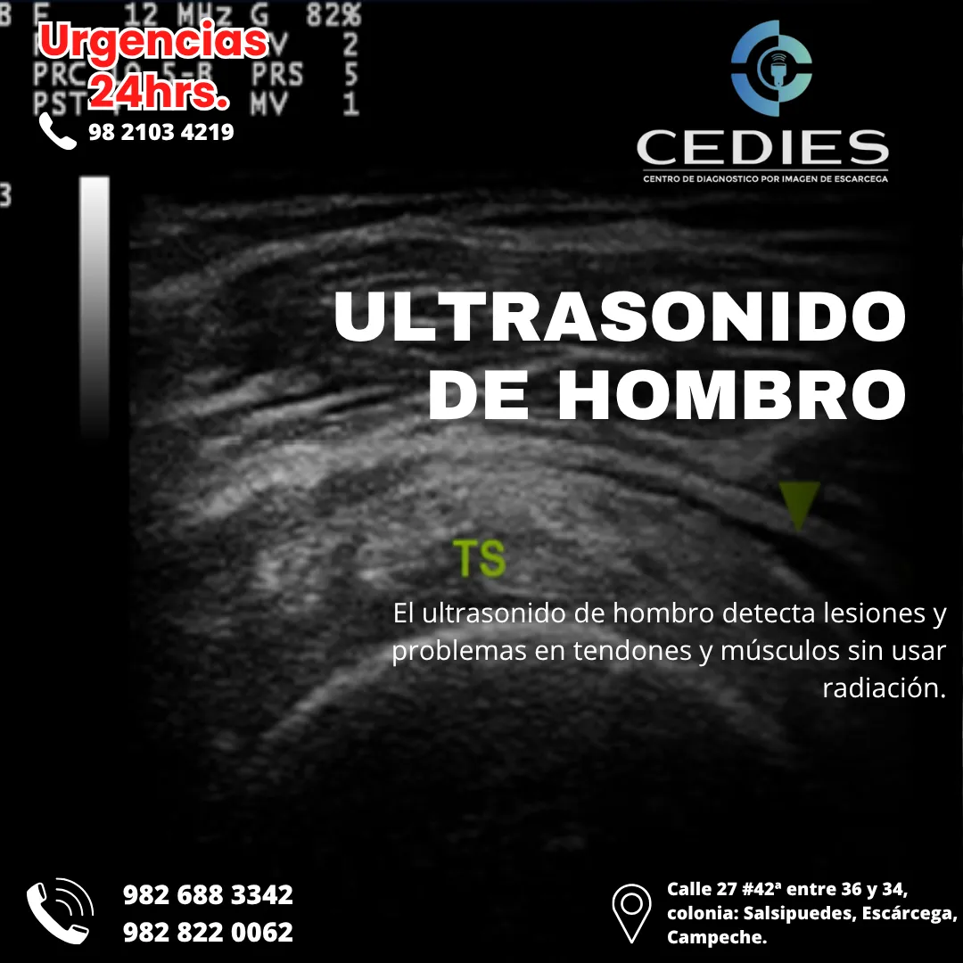 Diseño 62