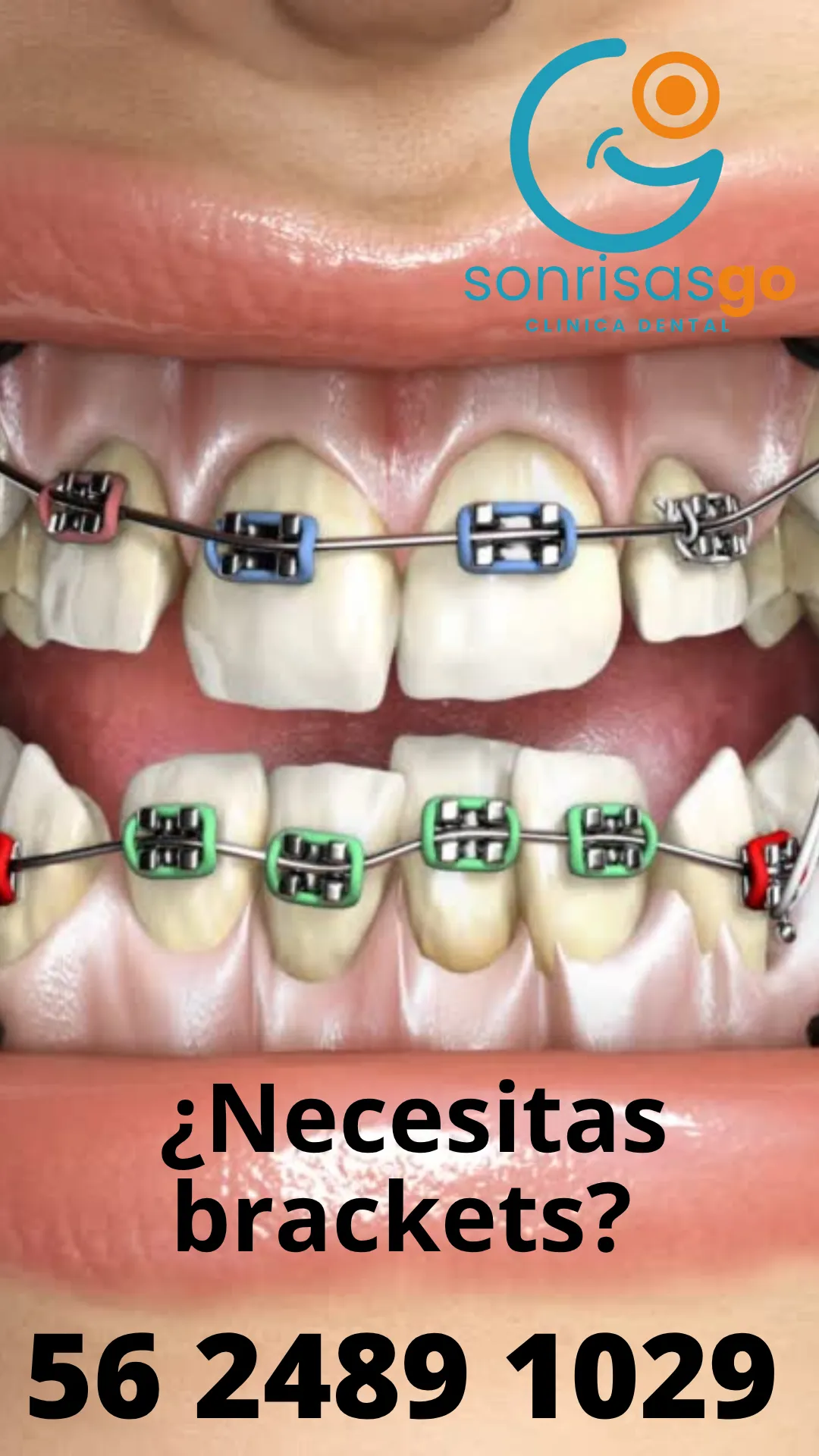 Diseño 147