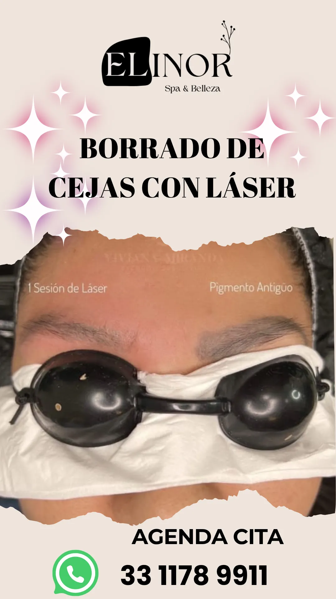 Diseño 103