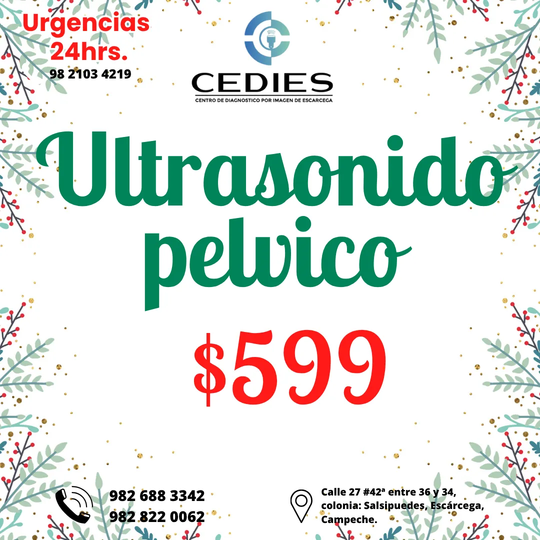 Diseño 84