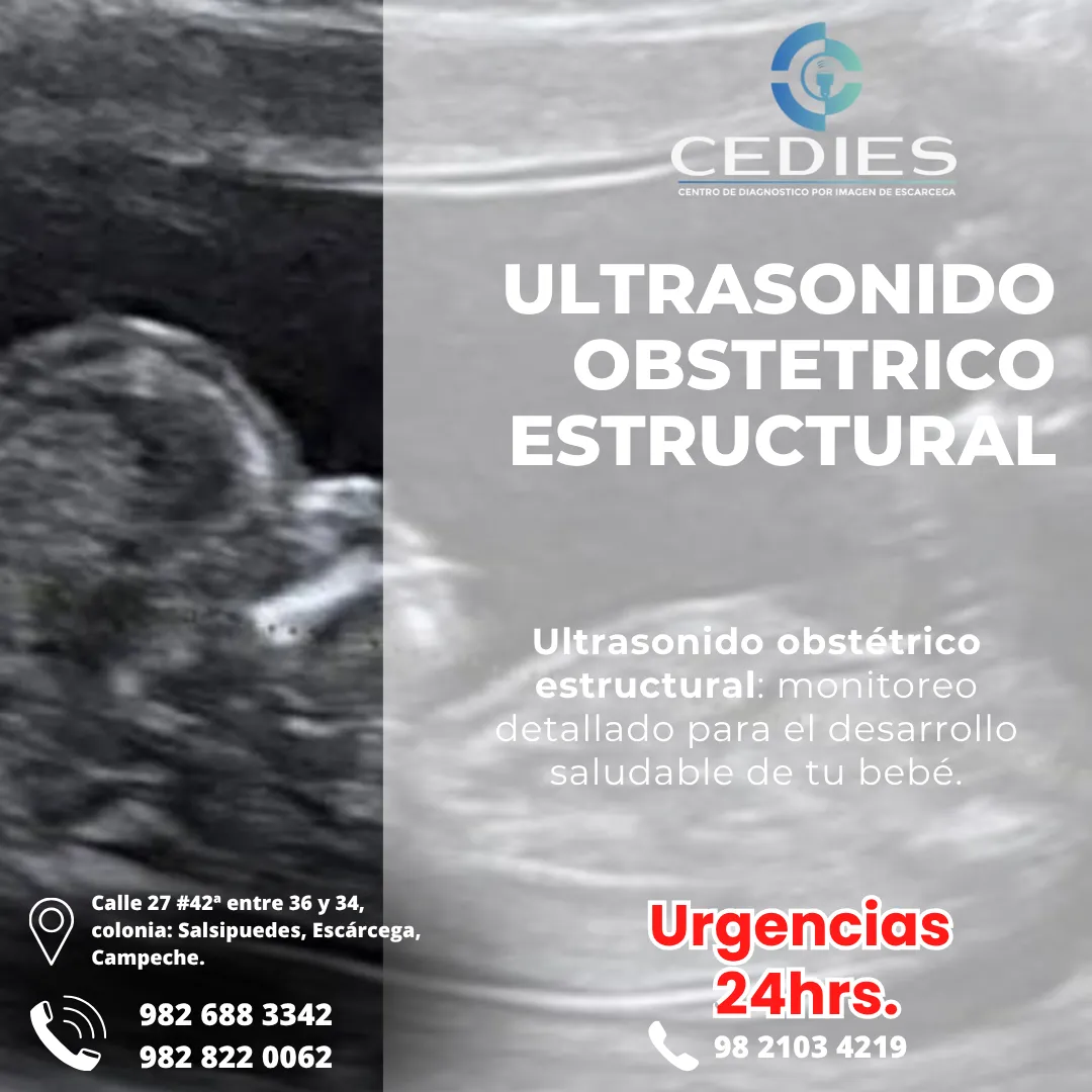 Diseño 21