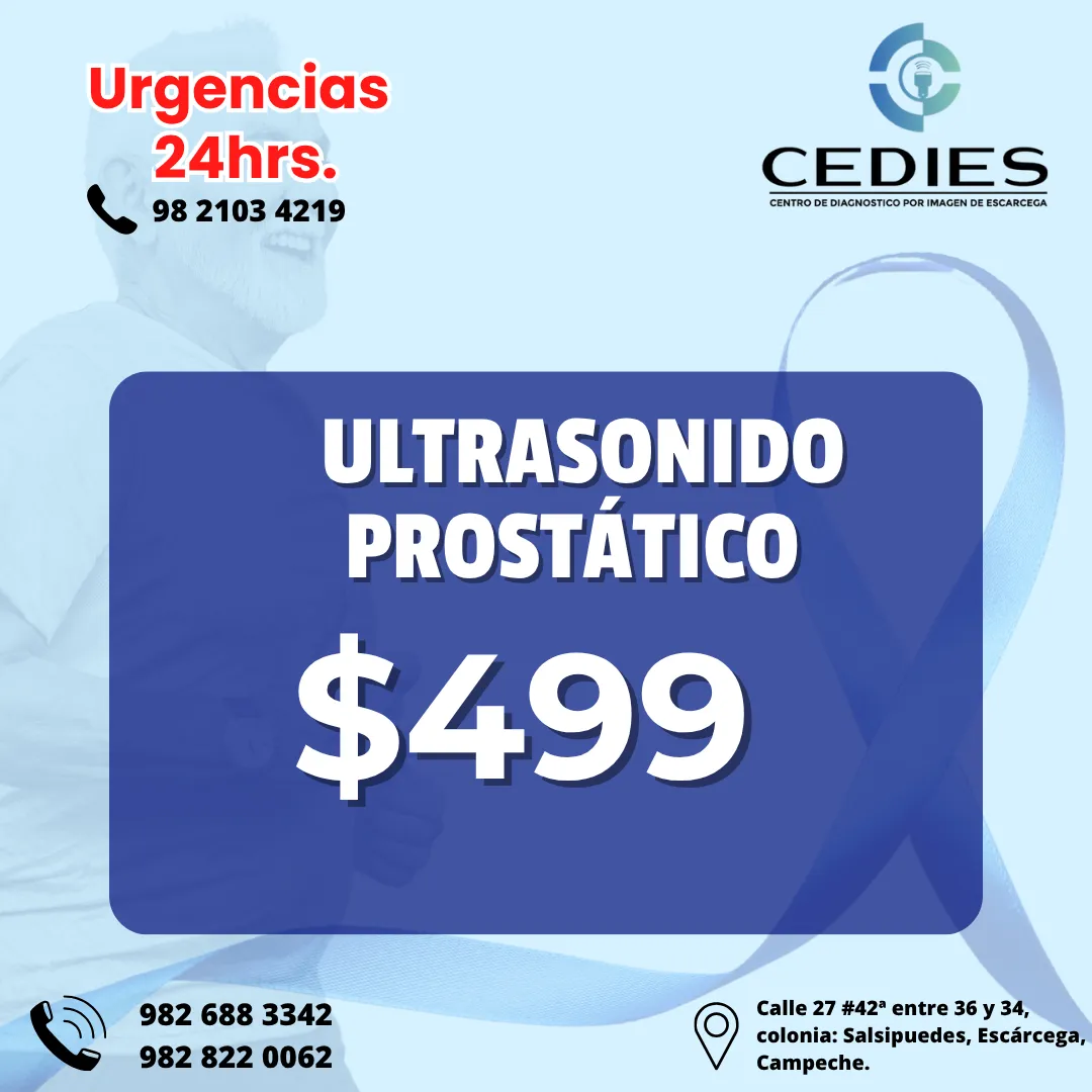 Diseño 59