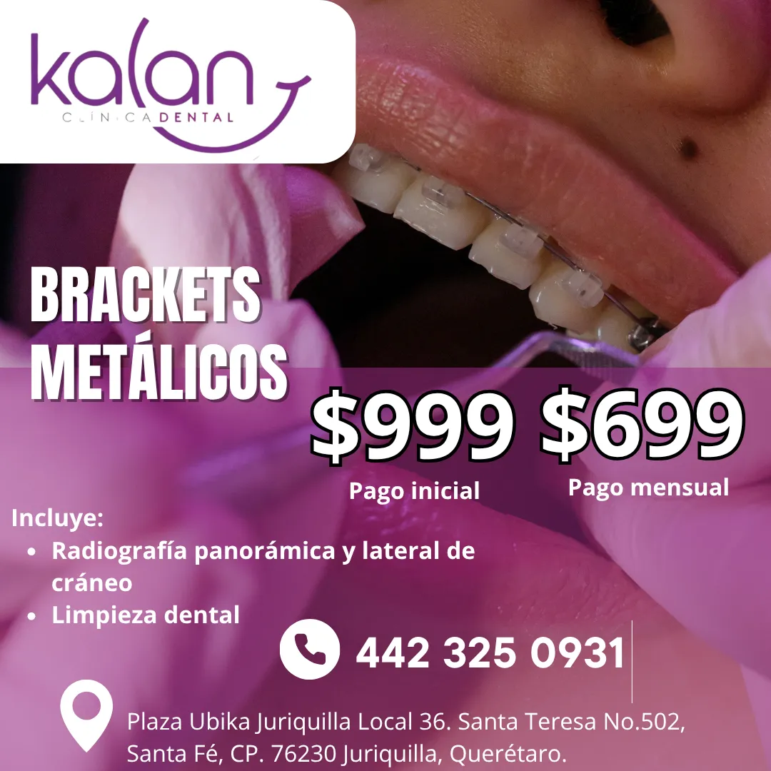 Diseño 33