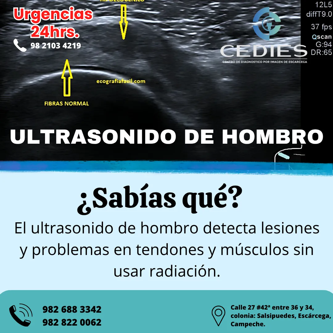 Diseño 69
