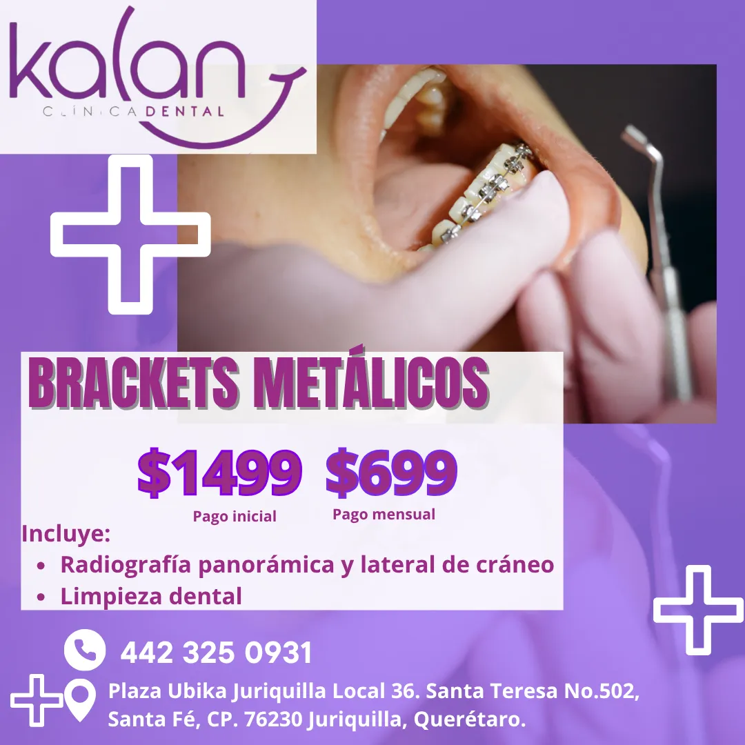 Diseño 75