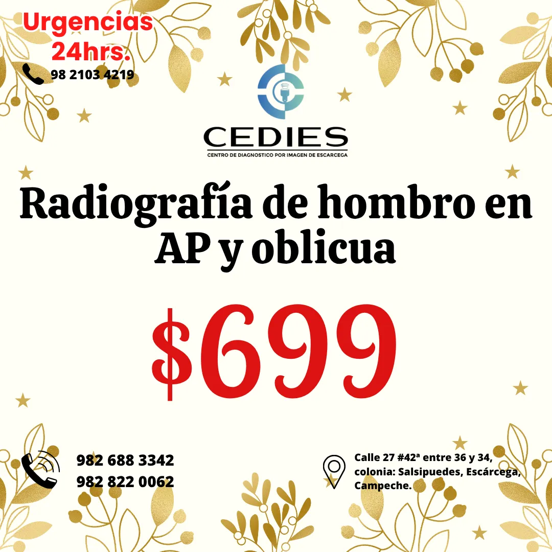 Diseño 92