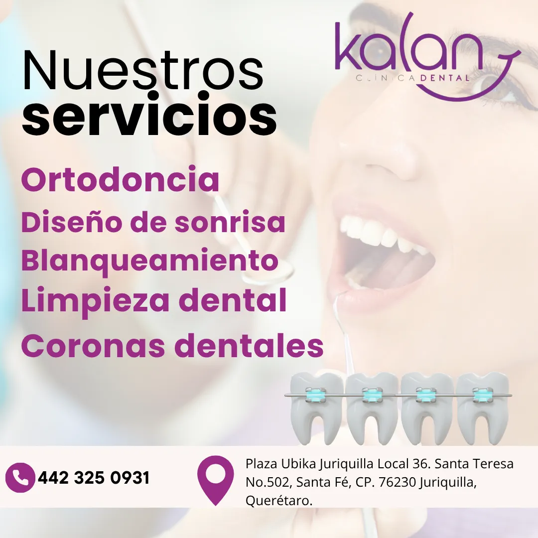 Diseño 45
