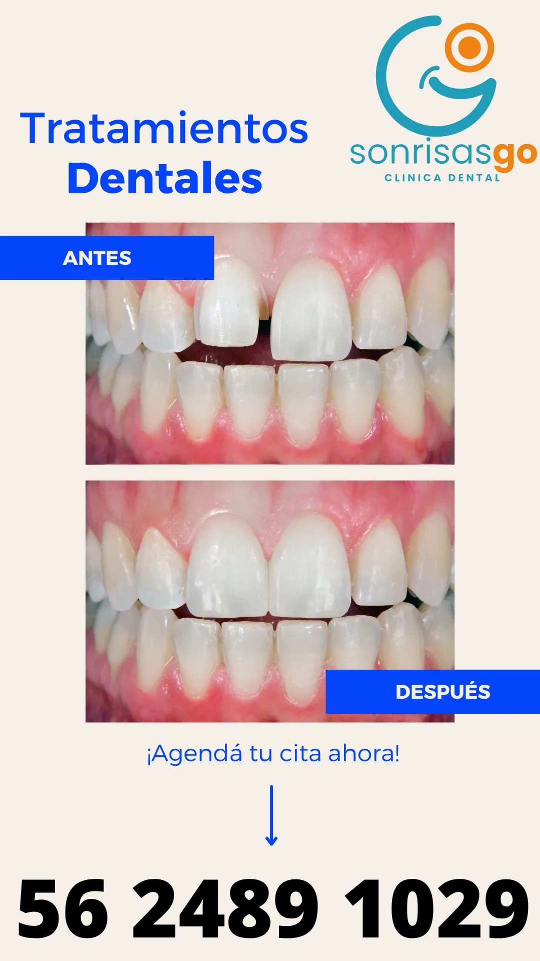 Diseño 104