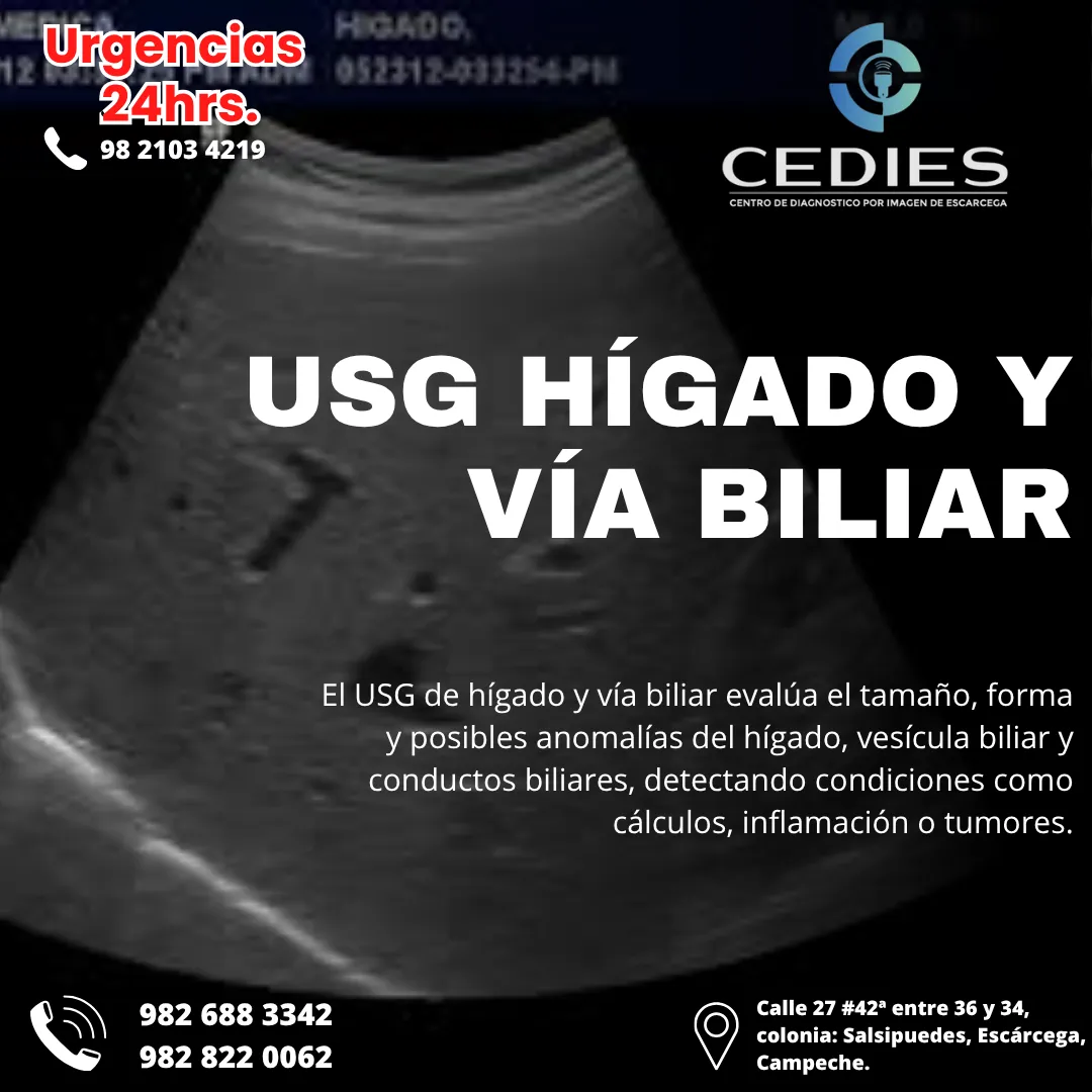 Diseño 66