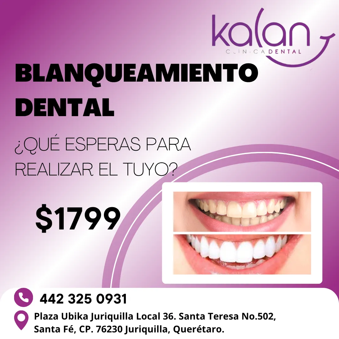Diseño 58