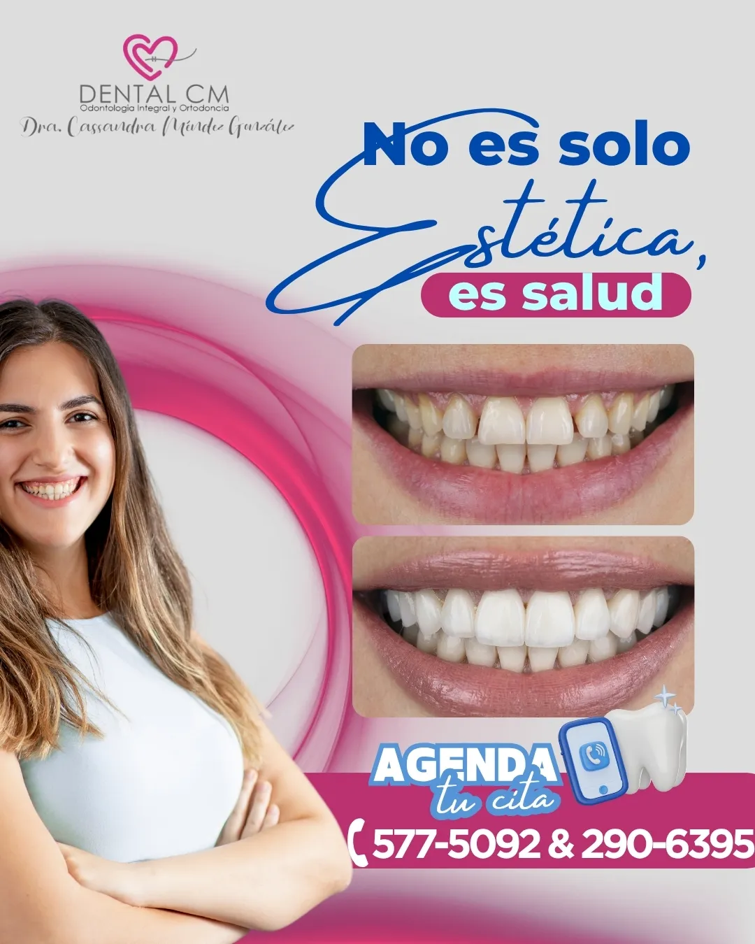 Diseño 2