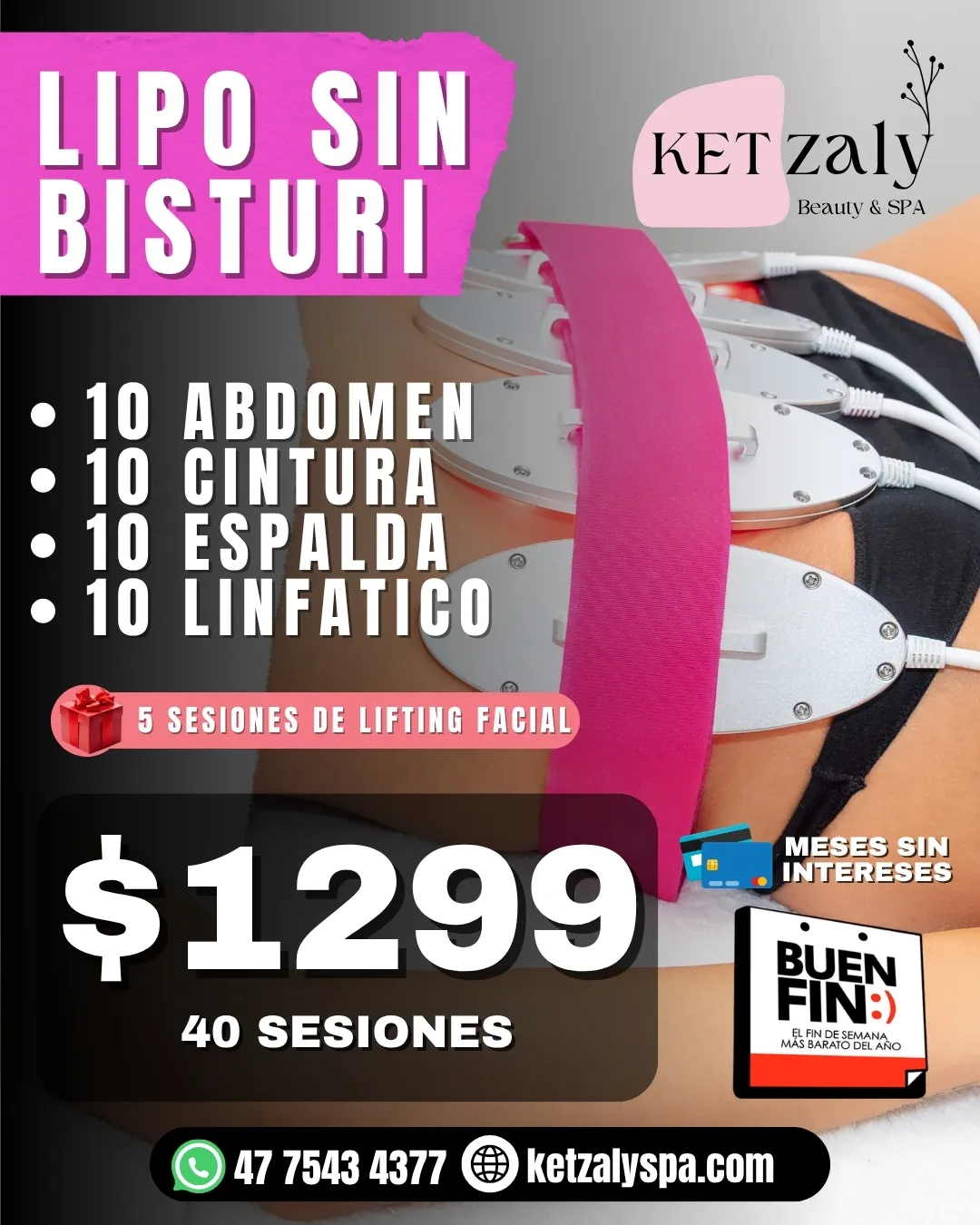 Ketzaly spa post 2026