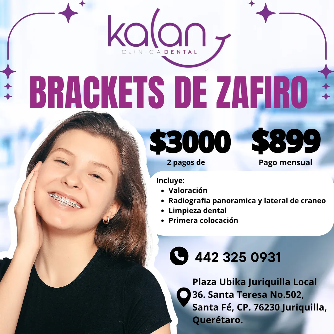 Diseño 47