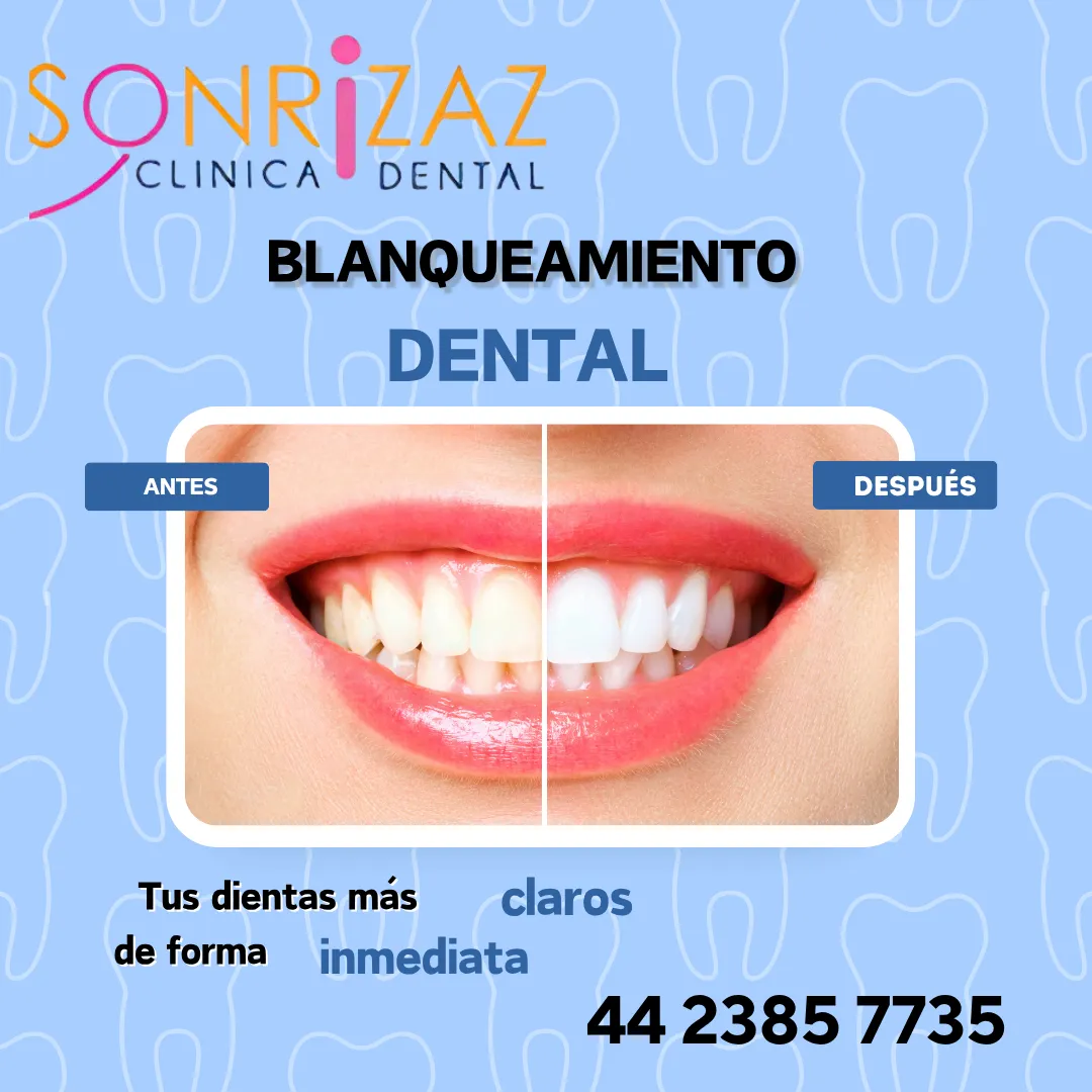 Diseño 30