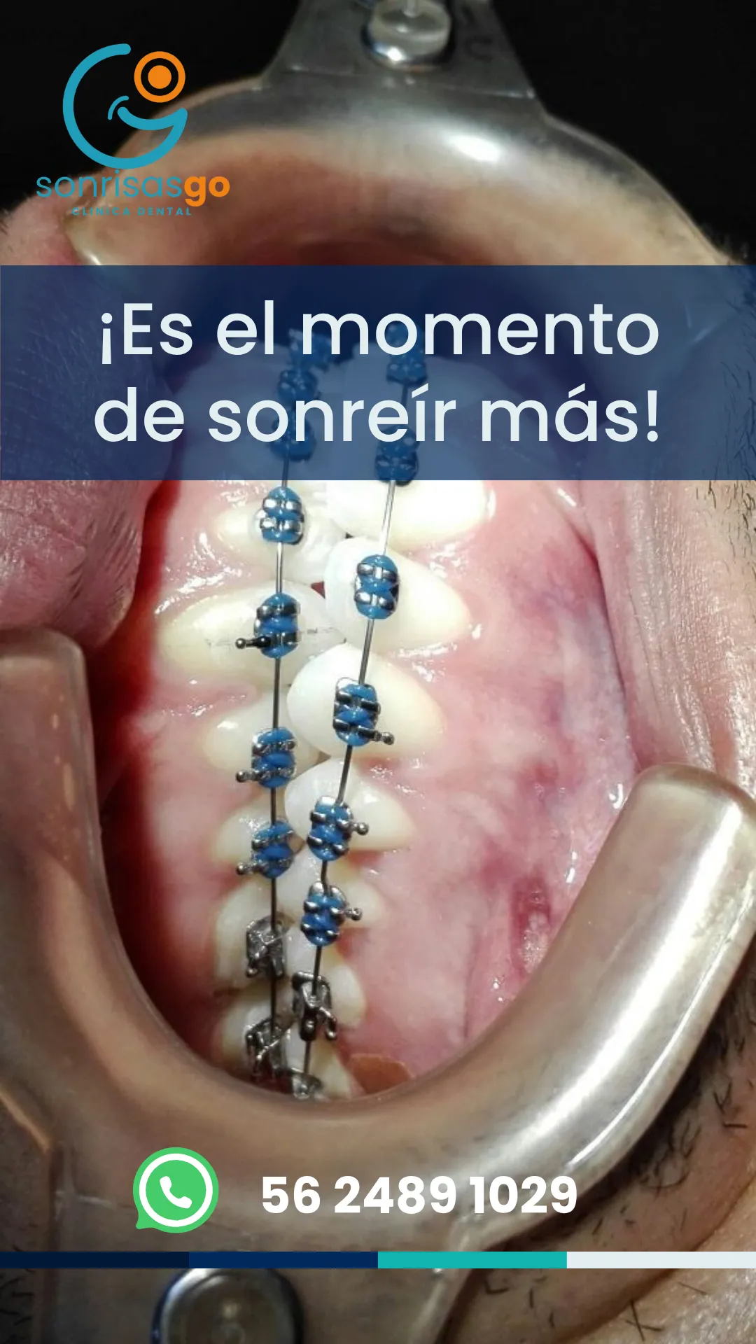 Diseño 2