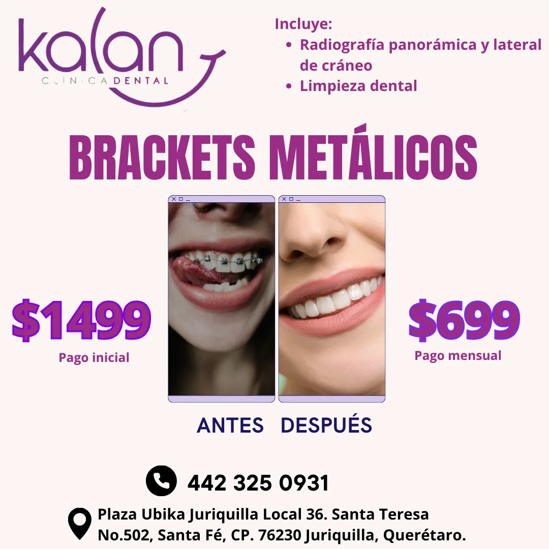 Diseño 93