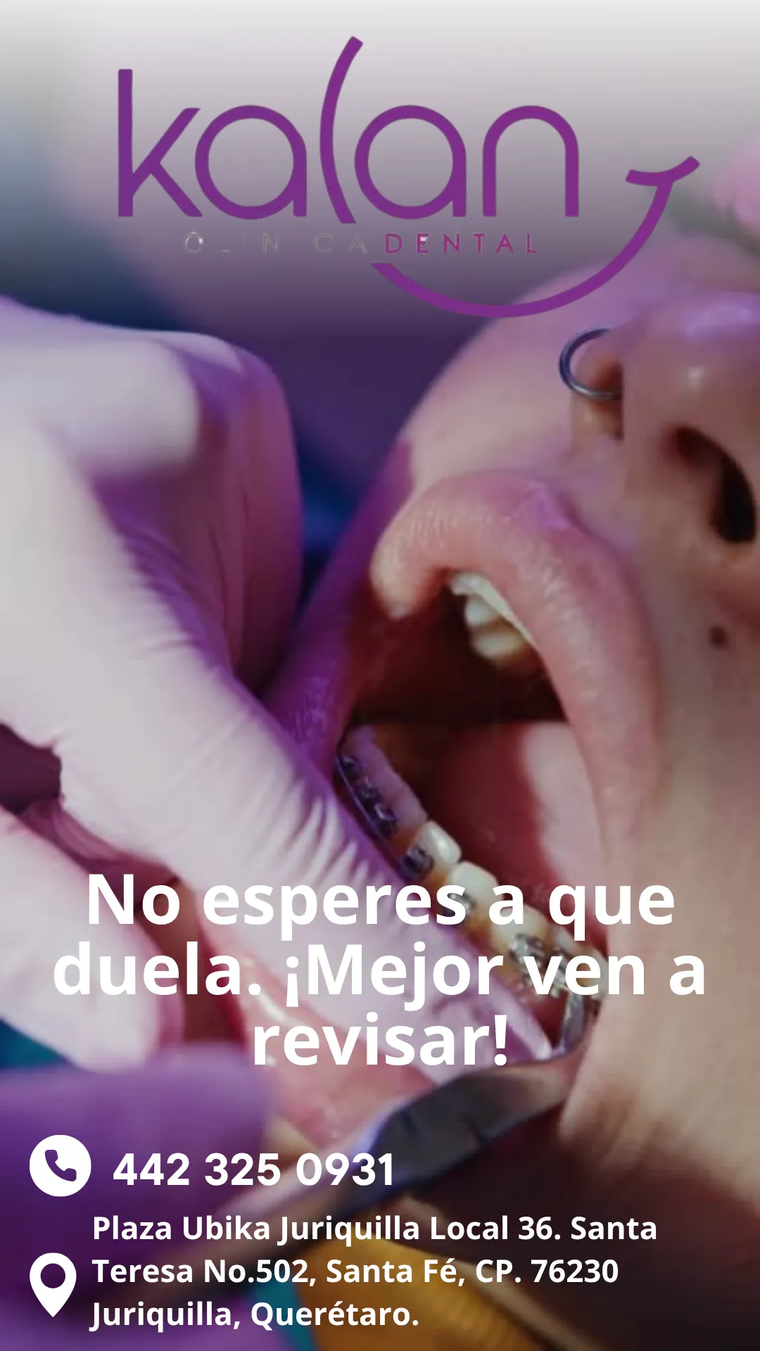 Diseño 50