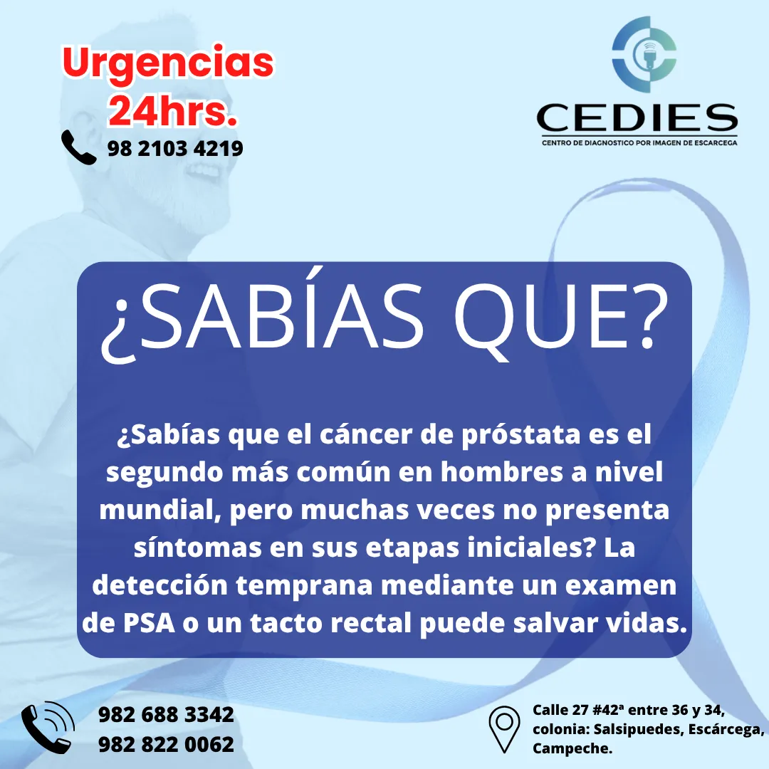 Diseño 60