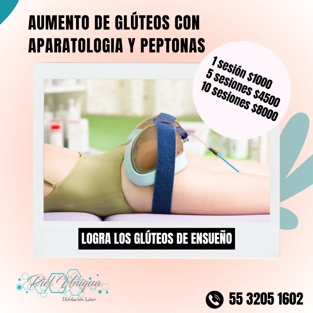 Diseño 52