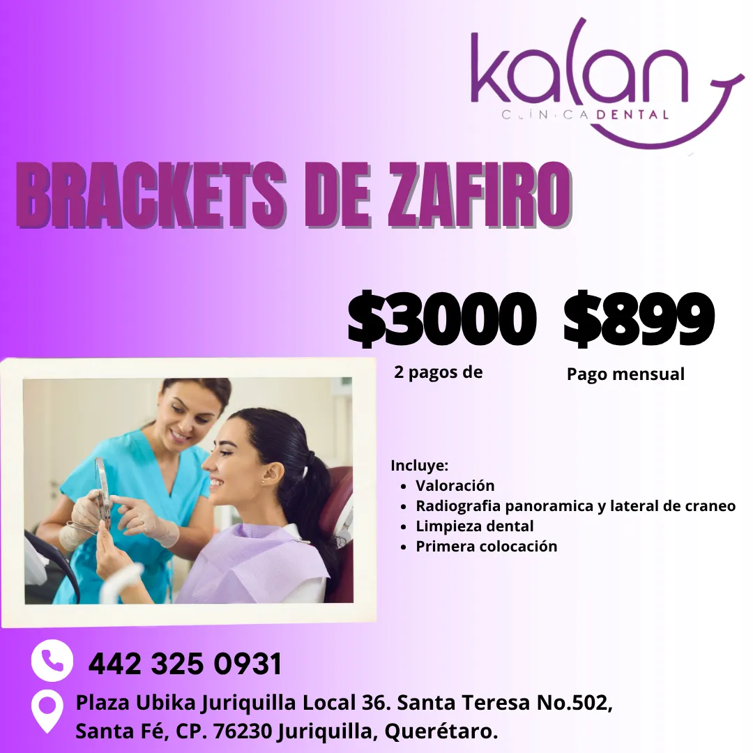 Diseño 60