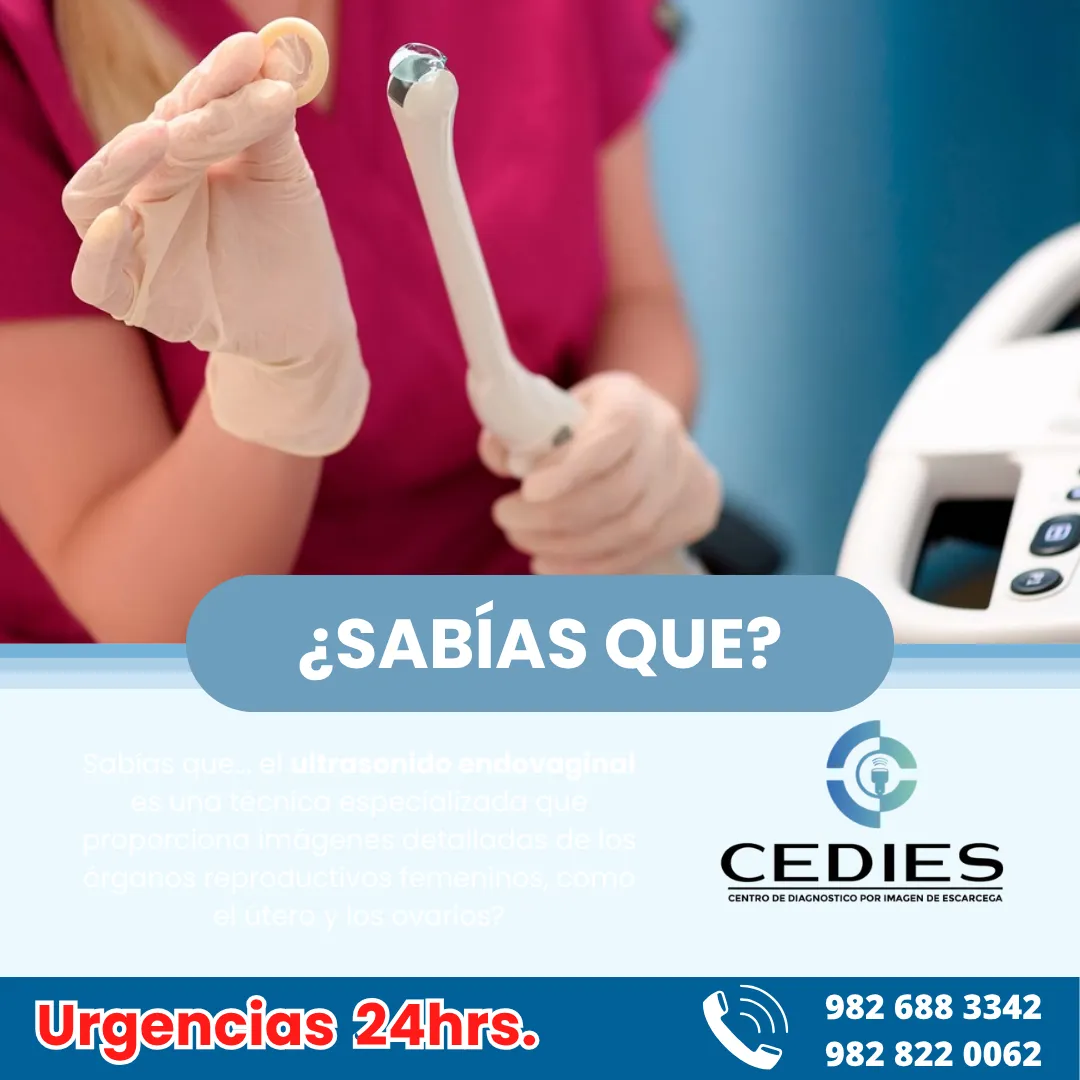 Diseño 36