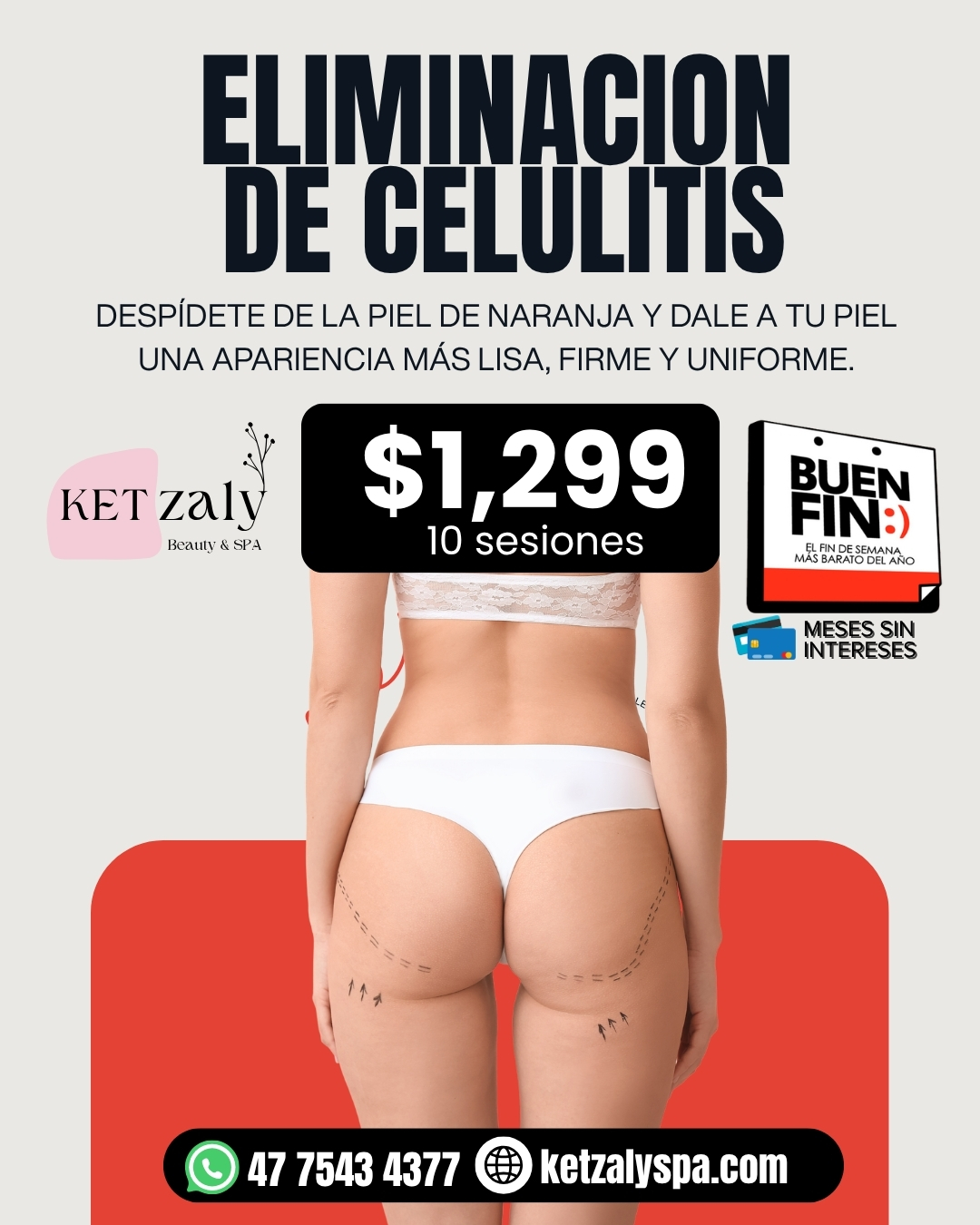 Diseño 6