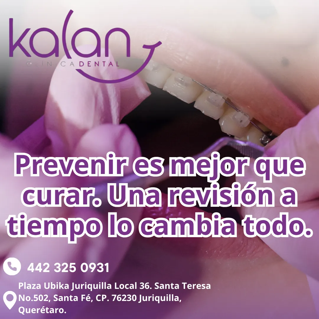 Diseño 52