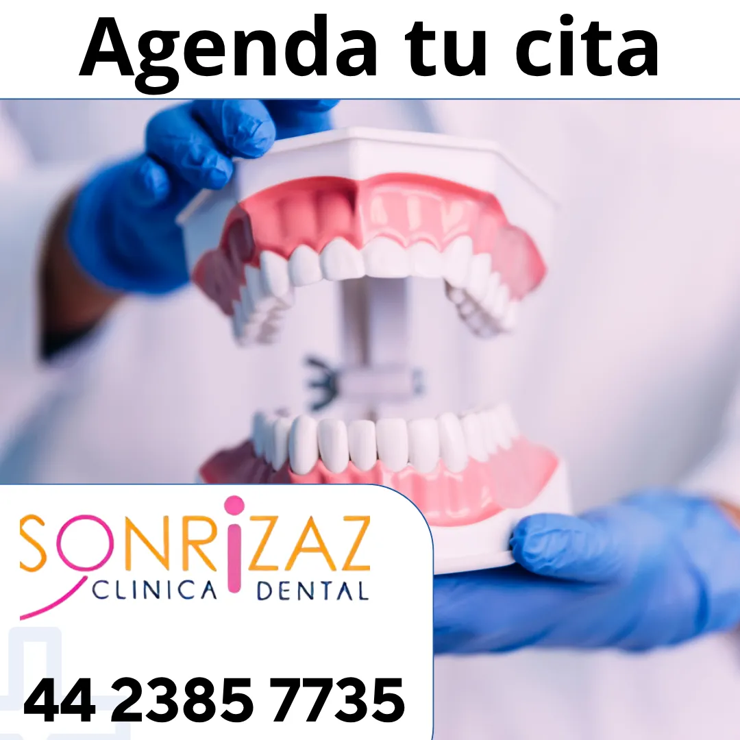 Diseño 14